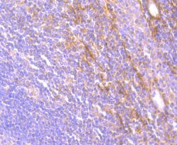 JAK3 Rabbit anti-Human, Clone: 1A1, Bioss 100 &mu;L; Unconjugated:Antibodies,