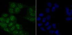 Phospho-ATM (Ser1981) Rabbit anti-Human, Clone: 3F10, Bioss 100 &mu;L;