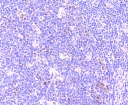 Phospho-ATM (Ser1981) Rabbit anti-Human, Clone: 3F10, Bioss 100 &mu;L;