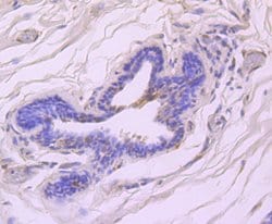 Phospho-ATM (Ser1981) Rabbit anti-Human, Clone: 3F10, Bioss 100 &mu;L;