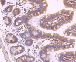 Phospho-MLKL (Ser345) Rabbit anti-Human, Clone: 7G4, Bioss 100 &mu;L; Unconjugated:Antibodies,