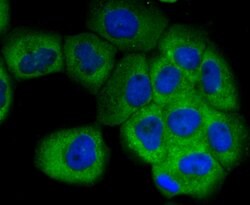 SCGB1A1 Rabbit anti-Human, Clone: 7G5, Bioss 100 &mu;L; Unconjugated:Antibodies,