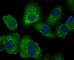 SCGB1A1 Rabbit anti-Human, Clone: 7G5, Bioss 100 &mu;L; Unconjugated:Antibodies,