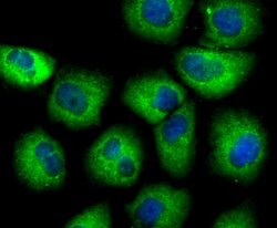 SCGB1A1 Rabbit anti-Human, Clone: 7G5, Bioss 100 &mu;L; Unconjugated:Antibodies,