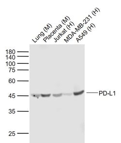 PD-L1 Monoclonal Antibody (8C14), Bioss 100 &mu;L; Unconjugated:Antibodies,