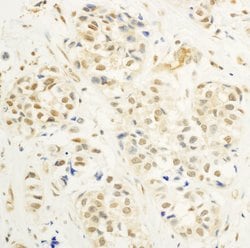 c-Myb Rabbit anti-Human, Polyclonal, Bethyl Laboratories 10 &mu;l; Unlabeled:Antibodies,
