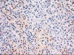 c-Myc Mouse anti-Human, Clone: OTI5G3, lyophilized, TrueMAB 100 &mu;g;