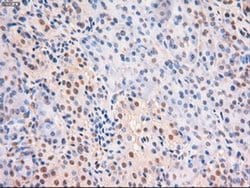 c-Myc Mouse anti-Human, Clone: OTI5G3, liquid, TrueMAB 100 &mu;L; Unconjugated:Antibodies,