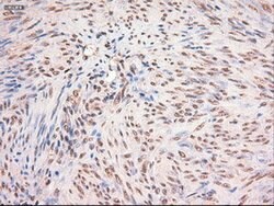 c-Myc Mouse anti-Human, Clone: OTI5G3, lyophilized, TrueMAB 100 &mu;g;