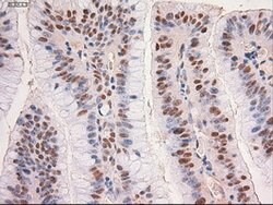 c-Myc Mouse anti-Human, Clone: OTI5G3, lyophilized, TrueMAB 100 &mu;g;