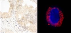 cAbl Rabbit anti-Human, Polyclonal, Bethyl Laboratories 100 &mu;L; Unconjugated:Antibodies,