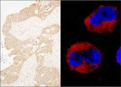cAbl Rabbit anti-Human, Polyclonal, Bethyl Laboratories 10 &mu;L; Unconjugated:Antibodies,