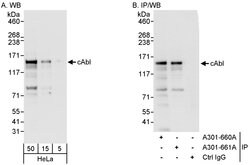 cAbl Rabbit anti-Human, Polyclonal, Bethyl Laboratories 100 &mu;L; Unconjugated:Antibodies,