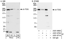 ch-TOG Rabbit anti-Human, Mouse, Polyclonal, Bethyl Laboratories 100 &mu;L;