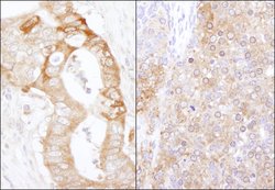 eEF2 Kinase Rabbit anti-Human, Mouse, Polyclonal, Bethyl Laboratories 100