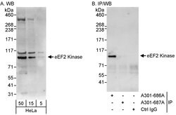 eEF2 Kinase Rabbit anti-Human, Polyclonal, Bethyl Laboratories 100 &mu;l;