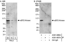 eEF2 Kinase Rabbit anti-Human, Mouse, Polyclonal, Bethyl Laboratories 100
