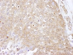eEF2 Kinase Polyclonal Antibody, Bethyl Laboratories 100 &mu;L; Unconjugated:Antibodies,