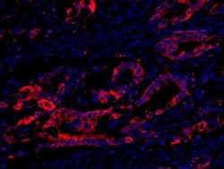 eEF2 Kinase Polyclonal Antibody, Bethyl Laboratories 100 &mu;L; Unconjugated:Antibodies,