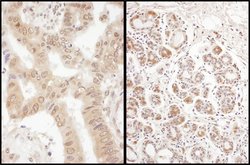 eIF2B delta/EIF2B4 Rabbit anti-Human, Polyclonal, Bethyl Laboratories 100
