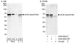 eIF2B delta/EIF2B4 Rabbit anti-Human, Polyclonal, Bethyl Laboratories 100