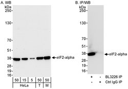 eIF2alpha/EIF2S1 Rabbit anti-Human, Mouse, Polyclonal, Bethyl Laboratories