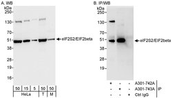 eIF2beta/EIF2S2 Rabbit anti-Human, Mouse, Polyclonal, Bethyl Laboratories