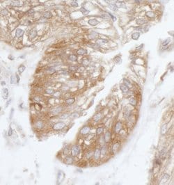 eIF3B/EIF3S9 Rabbit anti-Human, Polyclonal, Bethyl Laboratories 100 &mu;L;