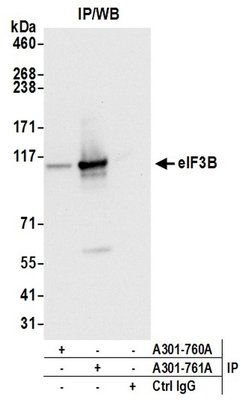 eIF3B/EIF3S9 Rabbit anti-Human, Polyclonal, Bethyl Laboratories 100 &mu;L;
