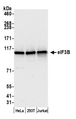 eIF3B/EIF3S9 Rabbit anti-Human, Polyclonal, Bethyl Laboratories 100 &mu;L;