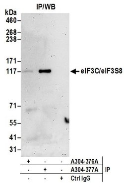 eIF3C/eIF3S8 Rabbit anti-Human, Polyclonal, Bethyl Laboratories 100 &mu;l;