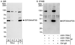 eIF3G/EIF3S4 Rabbit anti-Human, Polyclonal, Bethyl Laboratories 100 &mu;L;