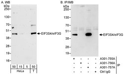 eIF3G/EIF3S4 Rabbit anti-Human, Polyclonal, Bethyl Laboratories 100 &mu;l;