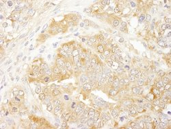 eIF3J/EIF3S1 Polyclonal Antibody, Bethyl Laboratories 100 &mu;L; Unconjugated:Antibodies,