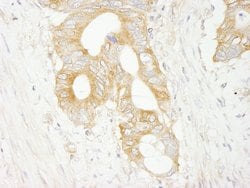 eIF3J/EIF3S1 Polyclonal Antibody, Bethyl Laboratories 100 &mu;L; Unconjugated:Antibodies,