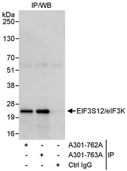 eIF3K/EIF3S12 Rabbit anti-Human, Polyclonal, Bethyl Laboratories 100 &mu;l;