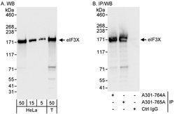 eIF3X Rabbit anti-Human, Polyclonal, Bethyl Laboratories 100 &mu;l; Unlabeled:Antibodies,