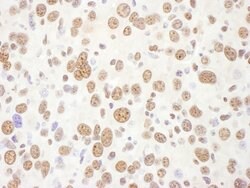 eIF4AIII/EIF4A3 Rabbit anti-Human, Mouse, Polyclonal, Bethyl Laboratories