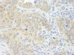 eIF4G1/eIF4GI Polyclonal Antibody, Bethyl Laboratories:Antibodies:Primary