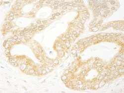 eIF4H Polyclonal Antibody, Bethyl Laboratories:Antibodies:Primary Antibodies