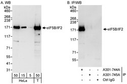 eIF5B/IF2 Rabbit anti-Human, Polyclonal, Bethyl Laboratories 100 &mu;L;