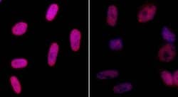 Phospho-gamma-H2AX (Ser139) Rabbit anti-Human, Mouse, Polyclonal, Bethyl