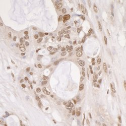Phospho-gamma-H2AX (Ser139) Polyclonal Antibody, Bethyl Laboratories 10