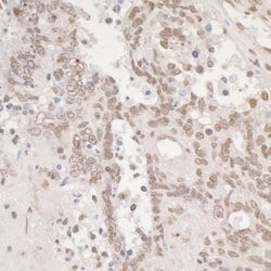 Phospho-gamma-H2AX (Ser139) Polyclonal Antibody, Bethyl Laboratories 10