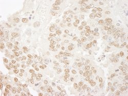 hPrp3p Polyclonal Antibody, Bethyl Laboratories:Antibodies:Primary Antibodies
