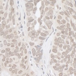 hSET1 Rabbit anti-Human, Polyclonal, Bethyl Laboratories 100 &mu;L; Unconjugated:Antibodies,