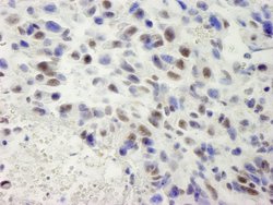 hSET1 Polyclonal Antibody, Bethyl Laboratories:Antibodies:Primary Antibodies