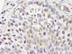 hSET1 Polyclonal Antibody, Bethyl Laboratories 10 &mu;L; Unconjugated:Antibodies,