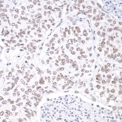hSET1 Recombinant Rabbit Monoclonal Antibody (BLR024E), Bethyl Laboratories