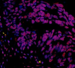 hSET1 Recombinant Rabbit Monoclonal Antibody (BLR024E), Bethyl Laboratories